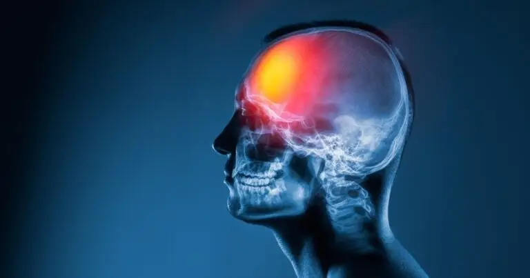 Traumatismo craneoencefálico y psicosis: ¿qué nos dice realmente la evidencia?